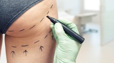 Why Is the Brazilian Butt Lift So Dangerous? 