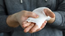 When To Get Stitches: Everything You Need to Know
